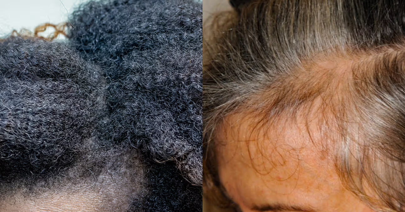 Say Goodbye to Hair Woes: Chatting About Mossy Habits Hair Growth Oil!