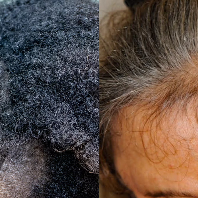 Say Goodbye to Hair Woes: Chatting About Mossy Habits Hair Growth Oil!